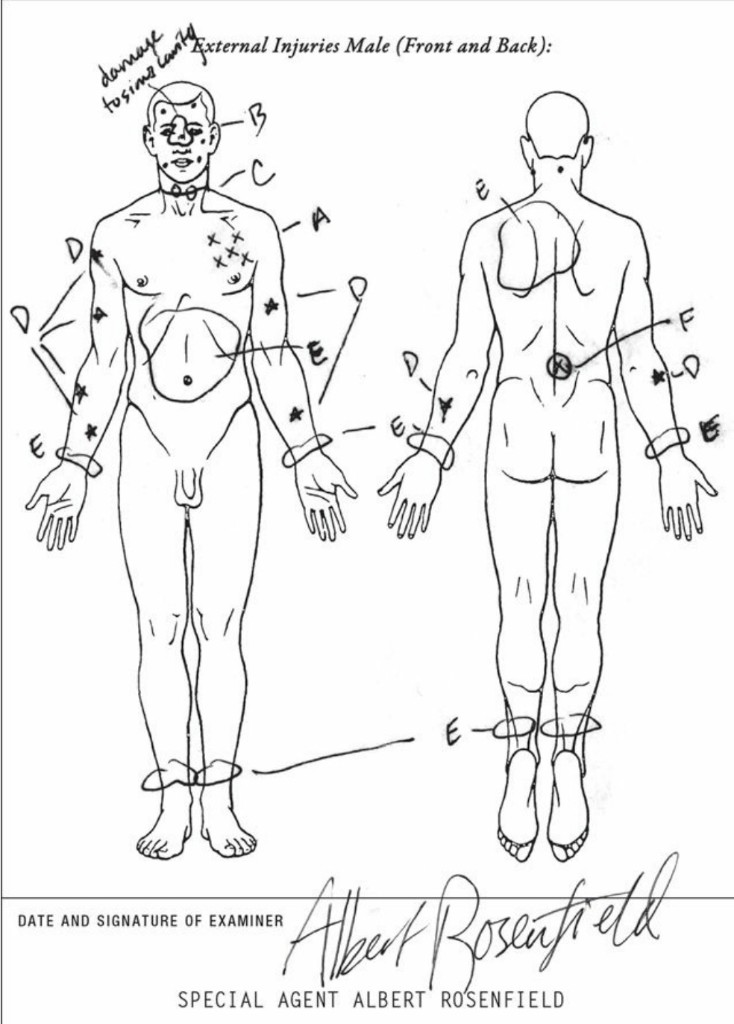 Final Dossier — Leo Johnson external injuries diagram signed by Albert Rosenfield